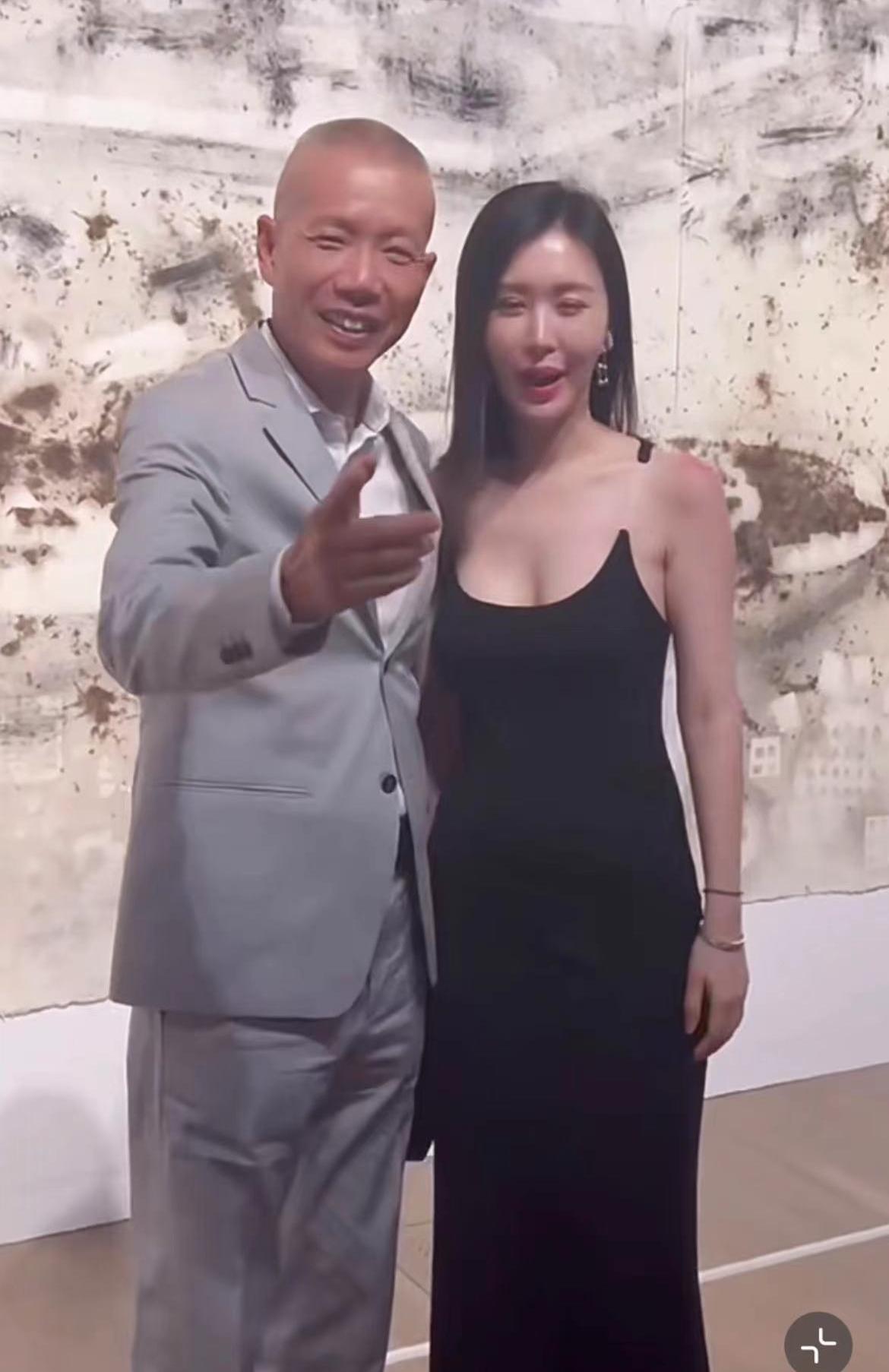 王石爱妻田朴珺裹浴巾出镜，肩膀两大处红肿伤痕，素颜模样变化大