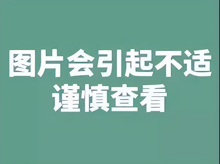切完肠息肉，收好这张复查表！