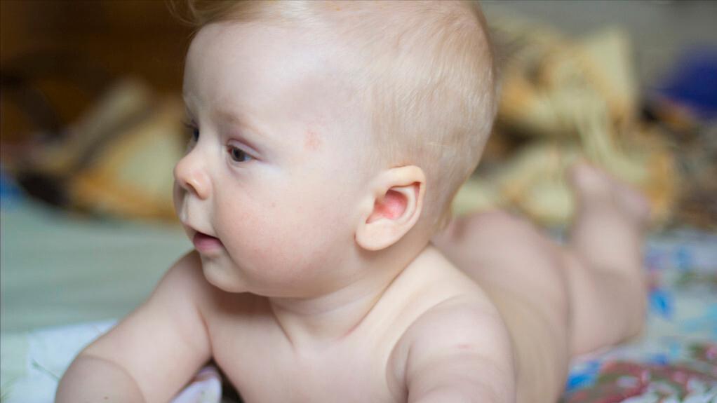 普萘洛尔可以用来治疗血管瘤吗,普萘洛尔治疗血管瘤的注意事项