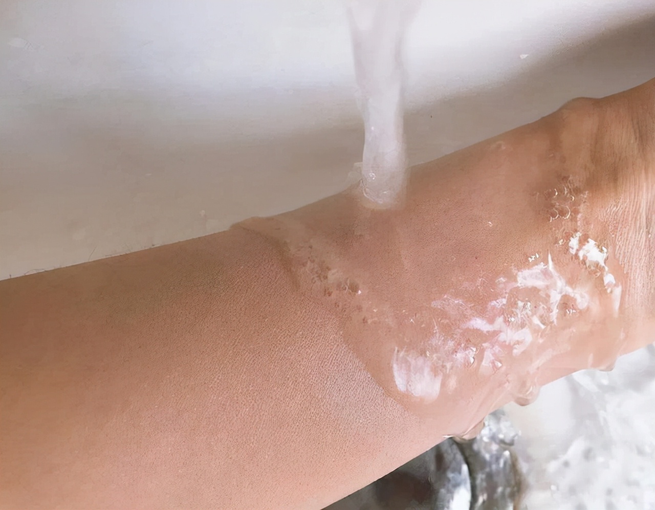 炉甘石洗剂价钱不一样效果一样吗,炉甘石洗剂为什么价格差挺多