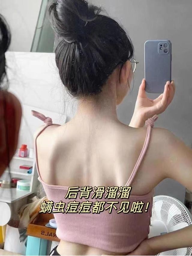 后背痘怎么祛痘,后背长痘中医祛痘