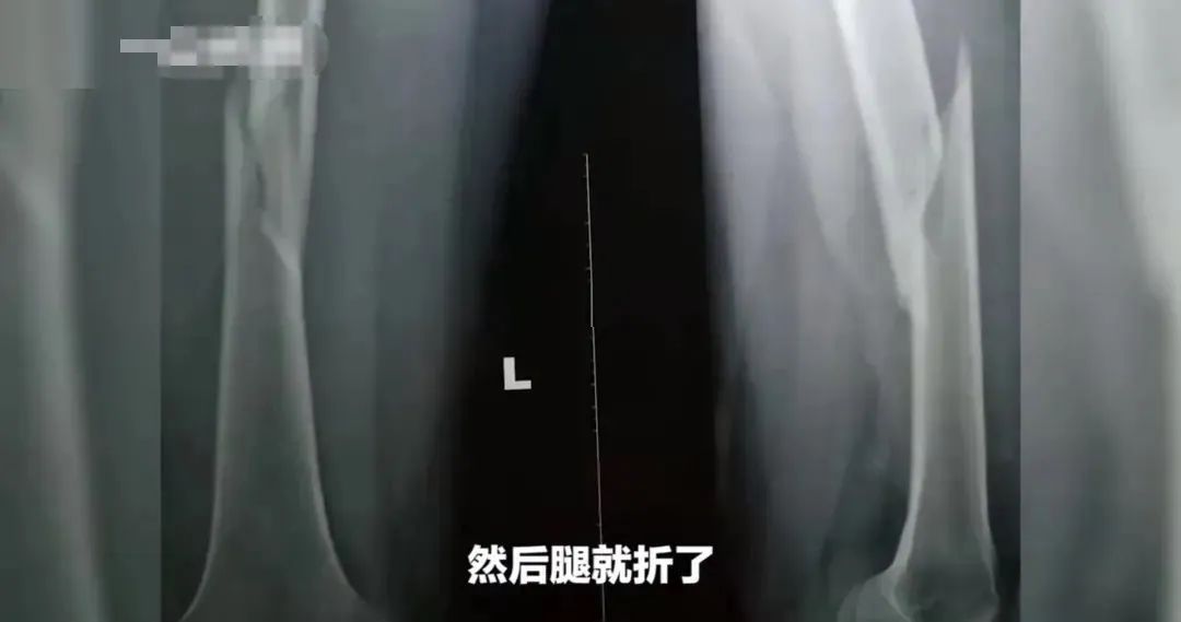 危险的健身房：中产避坑必修课