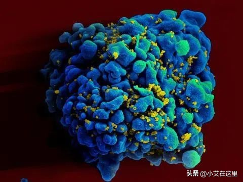 体外存在的艾滋病病毒能感染人吗？