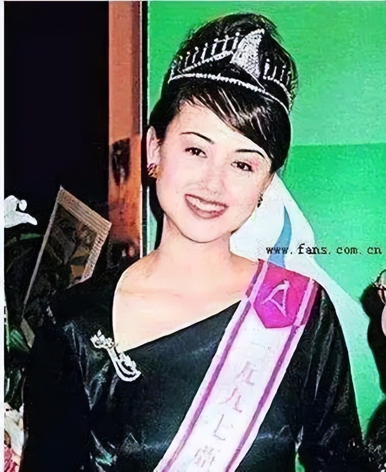 她曾是超女冠军整容失败,她曾是选美冠军