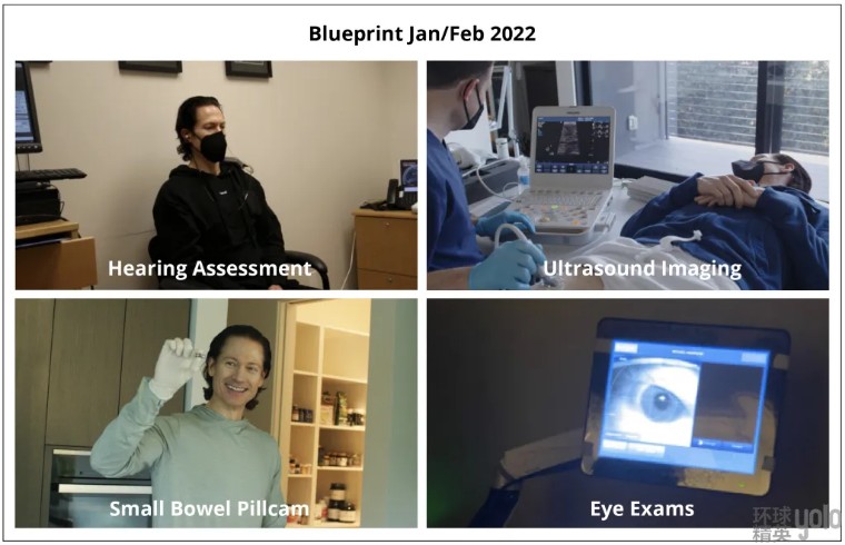 硅谷大佬重返18岁失败了吗,硅谷大佬返老还童