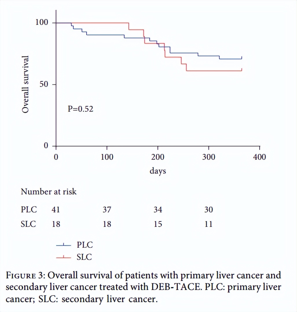 什么是原发性肝癌tace治疗 (tace是肝癌非手术治疗的首选疗法)