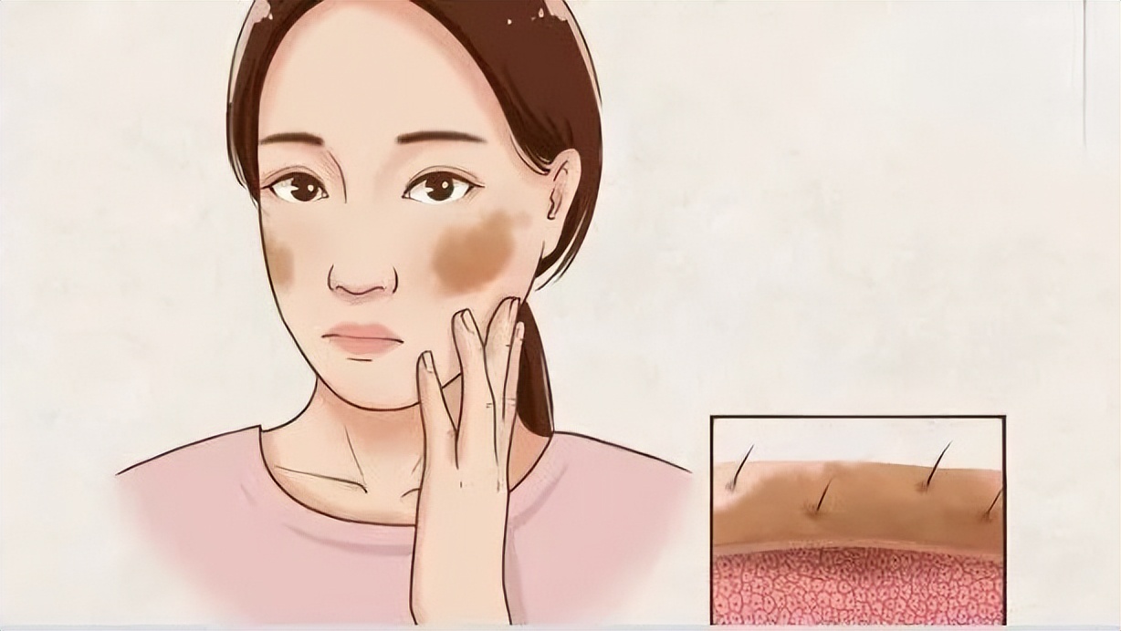 变态整容失败案例,变态整容医生为女儿报仇