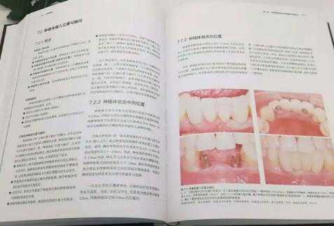 使用超声波电动牙刷有什么危害吗,电动牙刷的危害弊端