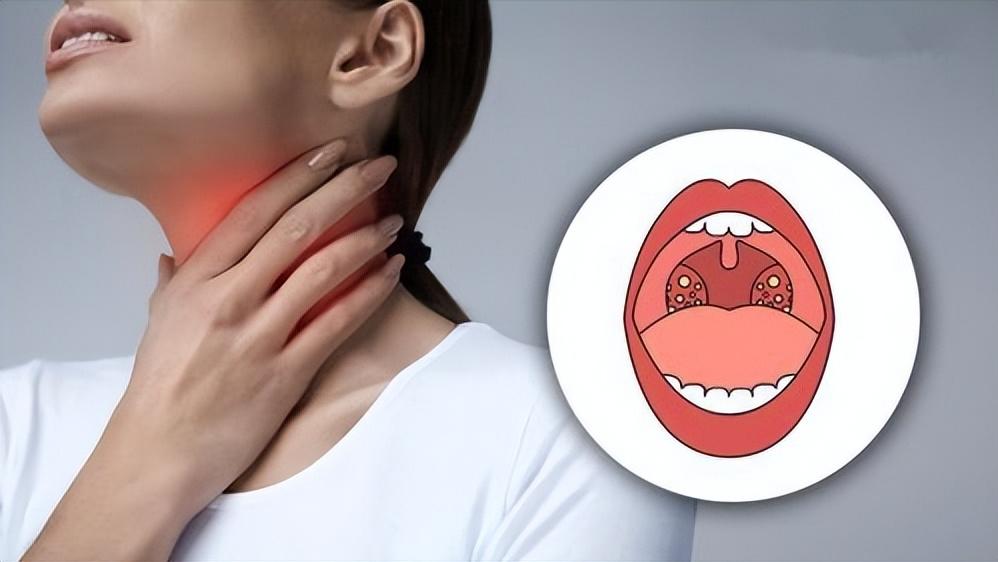 中国急性脑卒中诊治指南2014,中国脑卒中康复治疗指南pdf