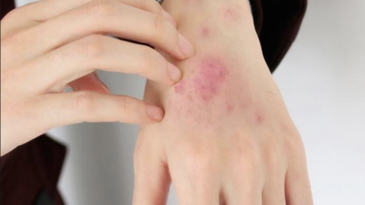 一瓶100毫升甲硝唑多少钱,几块钱的甲硝唑能有三种作用