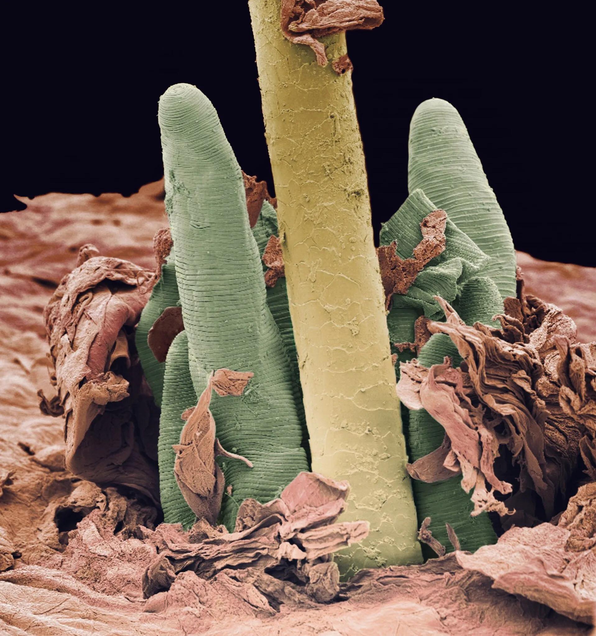 显微镜观察人体的四种组织图片,人体显微镜下的样子