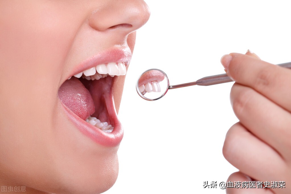牙龈无症状出血多提示什么血液病,牙龈发炎长时间流血是血液病