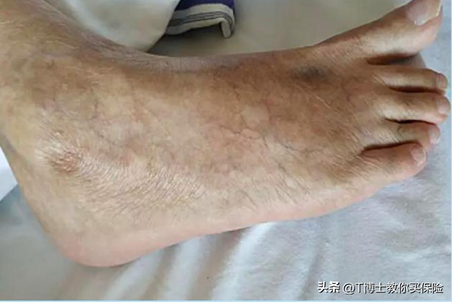 这种独一无二的资产，能让你晚年生活更好