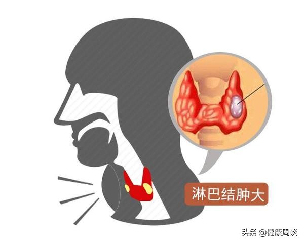 脖子上的小肉球多怎么回事,脖子上的小肉疙瘩是什么原因