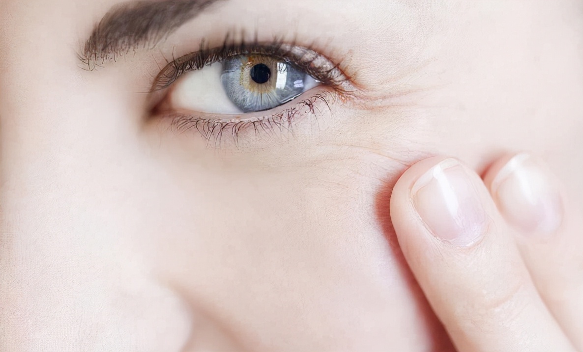 如何判断皱纹是假性干纹,人的脸部有暗纹怎么办