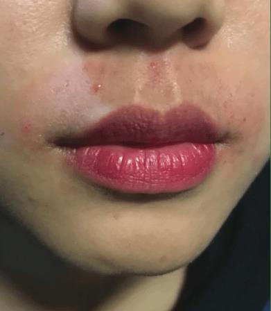 最顶级脱毛神器,无痛脱毛神器测评