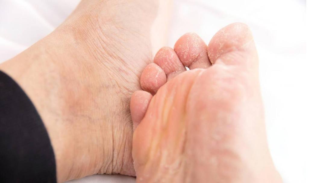 炉甘石洗剂，几块钱一瓶，却能治疗4种常见病，连世卫组织都推荐