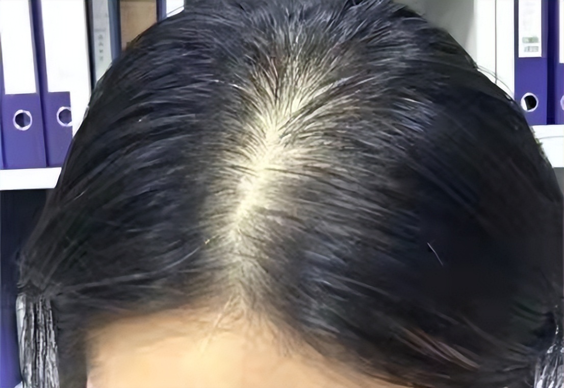 防脱发好物——FACHIOO法驰欧美肤净水花洒