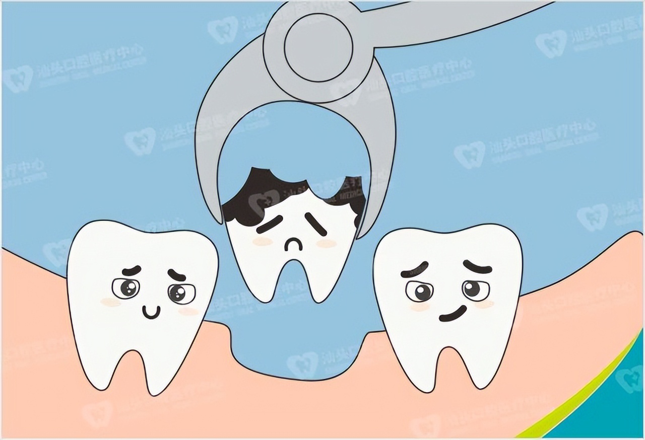 没蛀的牙齿痛需要做根管治疗吗,牙髓摘除是不是就是根管治疗