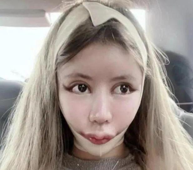 整容狂人整容100多次,整容狂魔手术200次