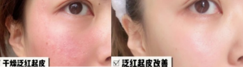 cemoy水乳孕妇可以用吗,后粉色水妍水乳孕妇可以用吗