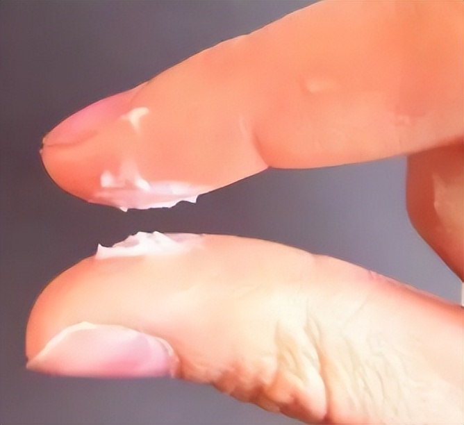 女性阴道有白色泡沫排出来，是咋回事？暗示了什么？医生给出答案