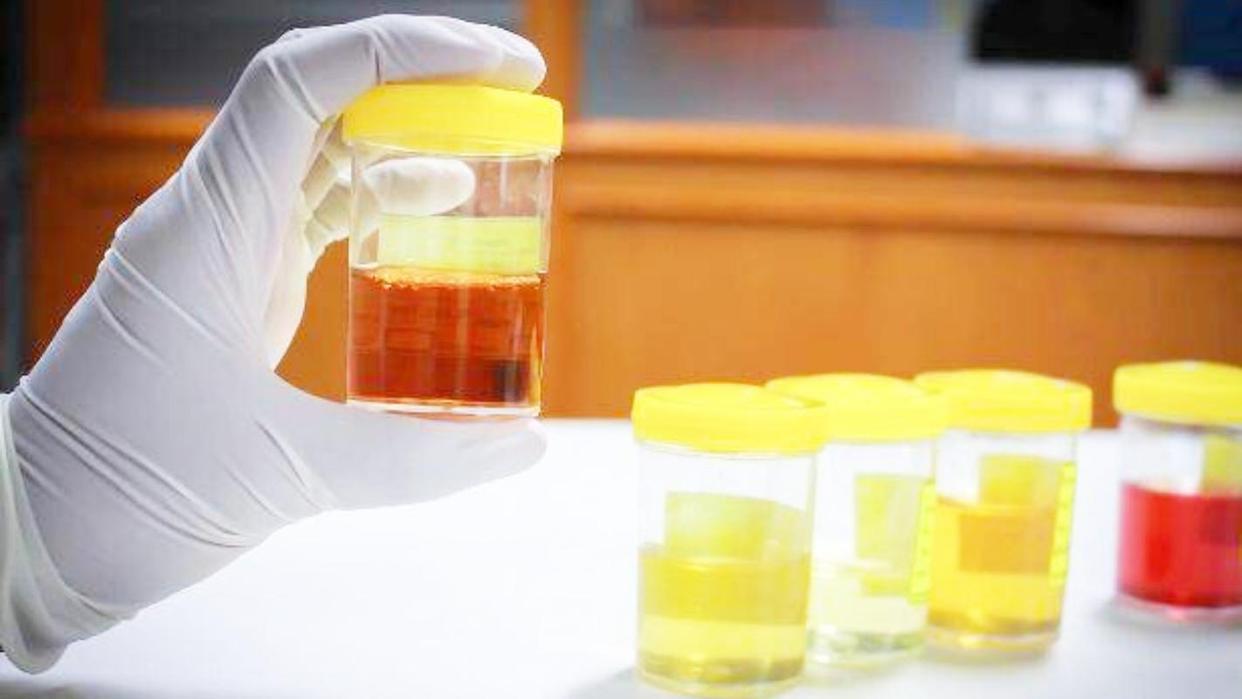 湿气重，身体三处会“变黄”？医生：少吃4果，或祛除湿气一身轻