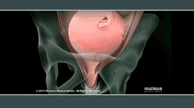 生孩子剖腹产与顺产对比,生孩子顺产和剖腹产对比