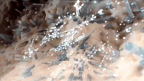 关节痛不要盲目判断滑膜炎,关节疼怎么判定是不是痛风