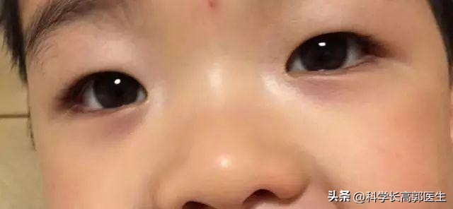 孩子太瘦一直不长肉怎么调理呢,孩子脾胃弱偏瘦矮小怎么办