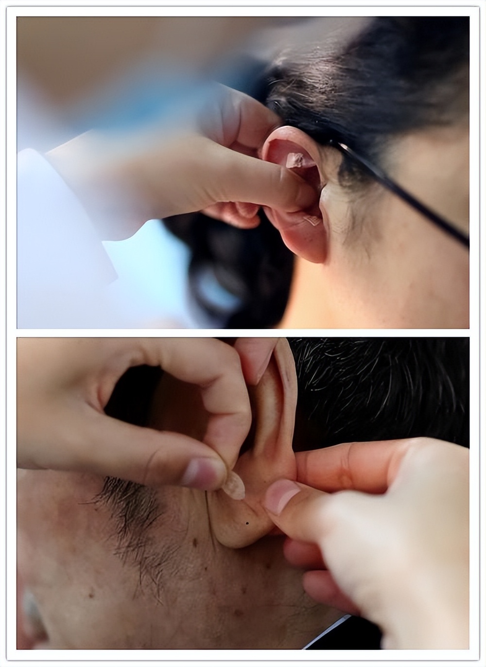 表情不受管理怎么办,表情不受控制是什么病