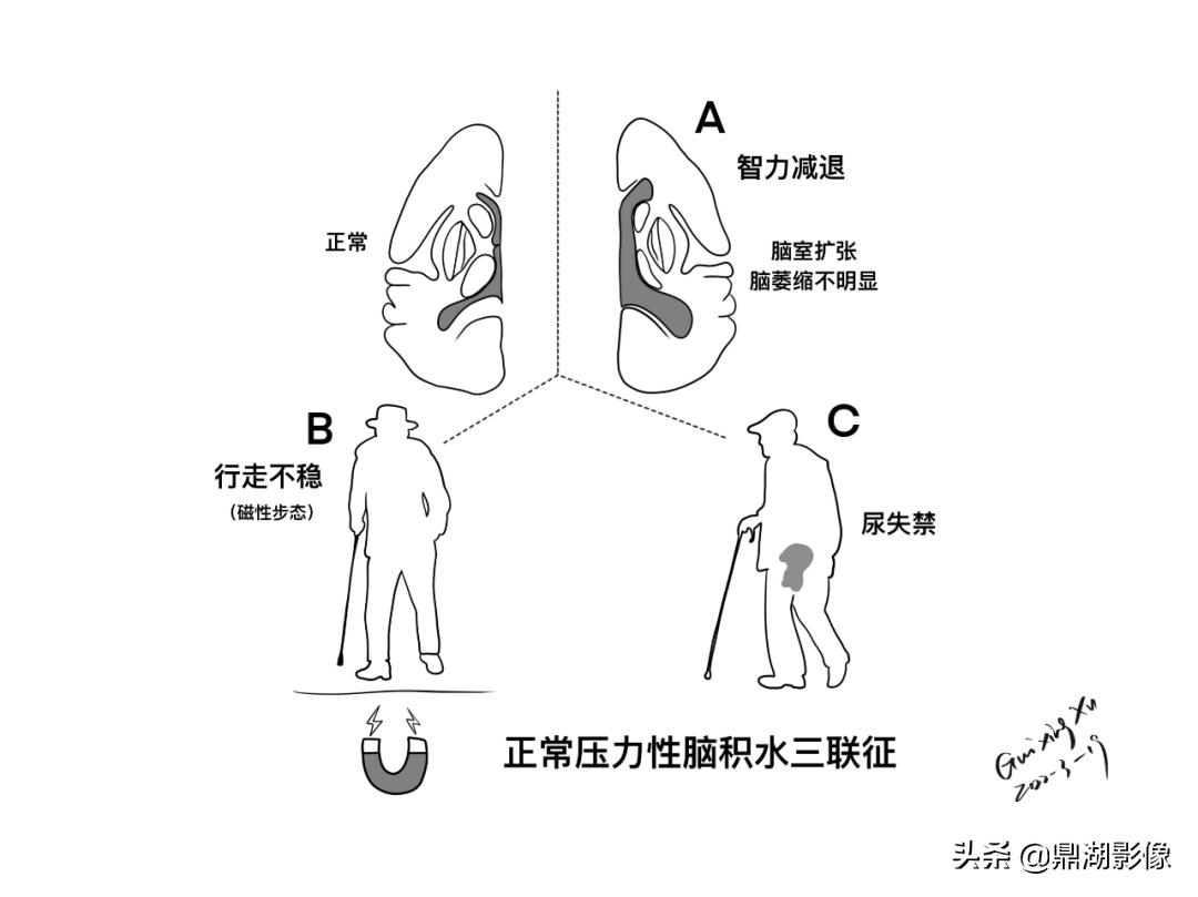 大脑皮层的解剖与定位,大脑解剖学习绘图笔记