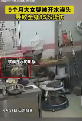儿童开水烫伤毁容,9个月女婴被烫伤后续