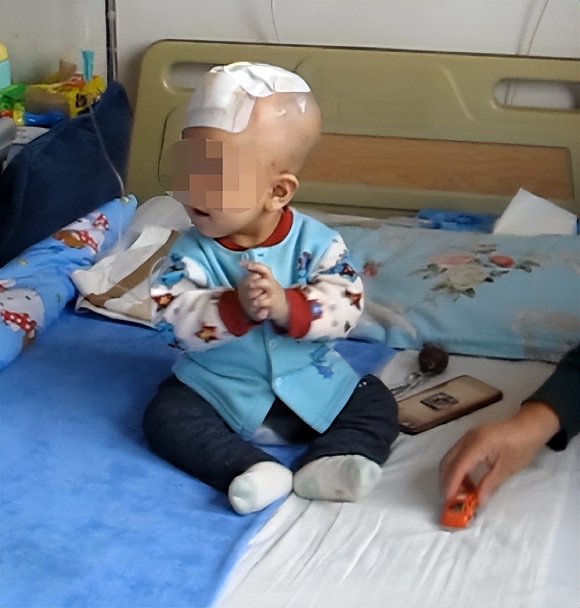 蛛网膜囊肿合并脑积水腹腔分流术,治疗蛛网膜囊肿引起脑积水严重吗