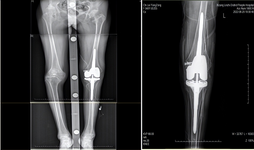 甯姪鎵惰传缇や紬瑙ｅ喅鍥伴毦,鎰熻阿钘忔棌鍚岃優鐨勪俊浠讳笌鏀寔