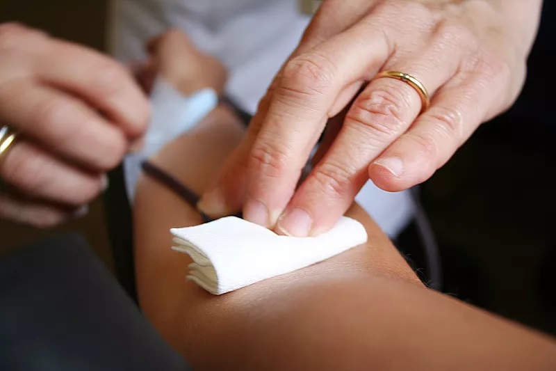 警惕艾滋病皮肤病,艾滋病会出现的初期皮肤病