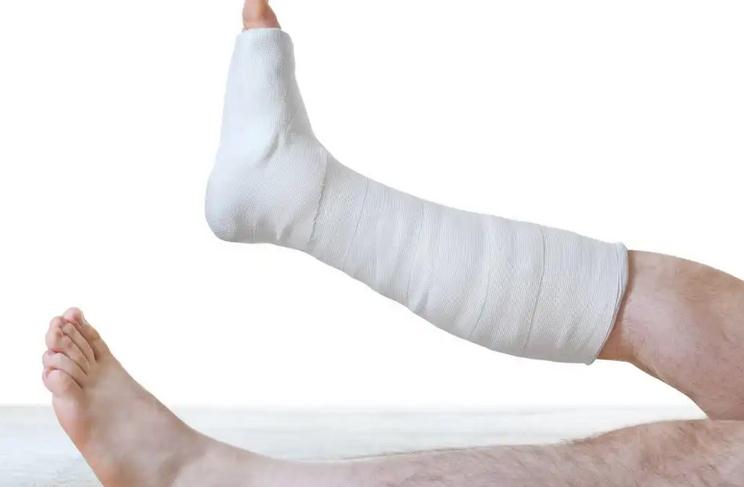 脚下楼梯踏空扭伤了肿了冰敷多久,脚下楼梯踏空扭伤了挂什么科室