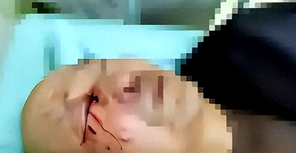 老教授被养老院虐待,89岁老人被护工脱裤殴打