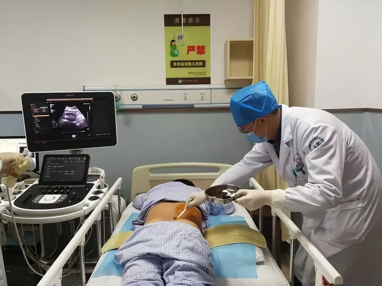 肺癌肾病综合症,32岁女性双下肢水肿