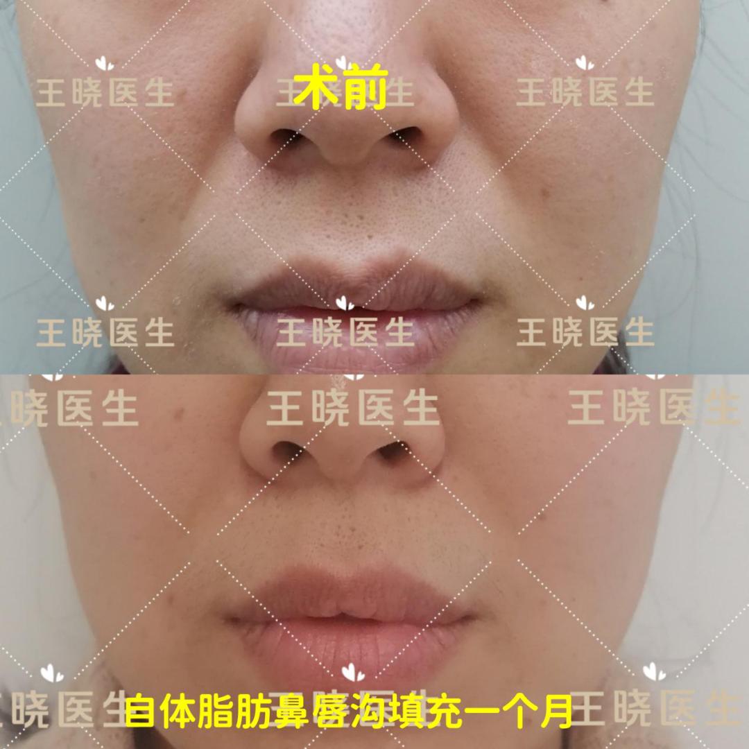 夏天美容整形,医院美容护肤项目