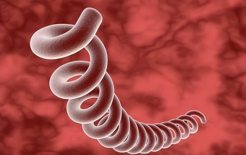 得了梅毒有什么症状？身上会痒吗？梅毒能治愈吗？建议了解一下