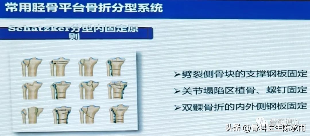 国家卫健委主办的骨创伤专项能力培训项目----下肢损伤学习班