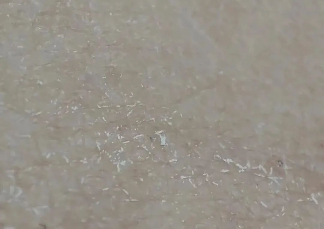 蚊子叮咬止痒消肿膏推荐,蚊虫叮咬止痒药膏测评推荐