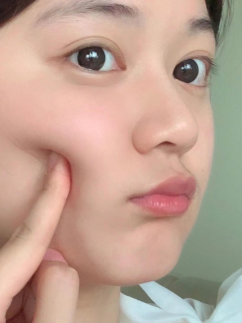 皮肤差怎么护肤都不改善怎么回事,为什么每天早晚护肤了皮肤还是干