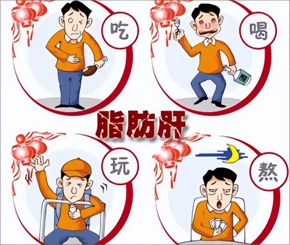 年轻人重度脂肪肝怎么办,脂肪肝多久发展成重度脂肪肝