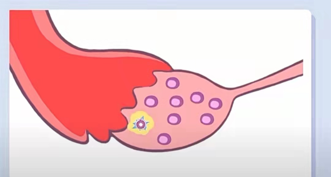 吃什么能生下聪明宝宝,吃什么能养卵子的质量
