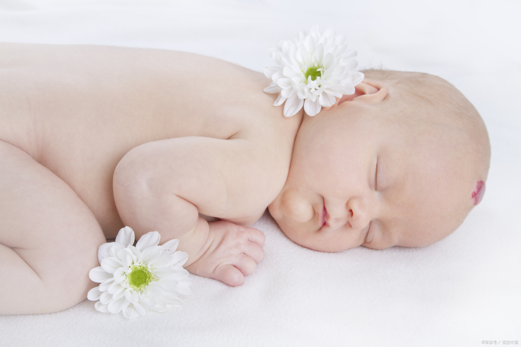 血管瘤治好后为什么又反复复发,血管瘤为啥容易复发