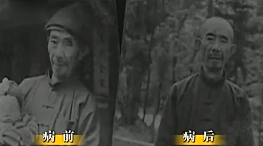 一夜间全村遭鬼剃头,山村鬼剃头真相