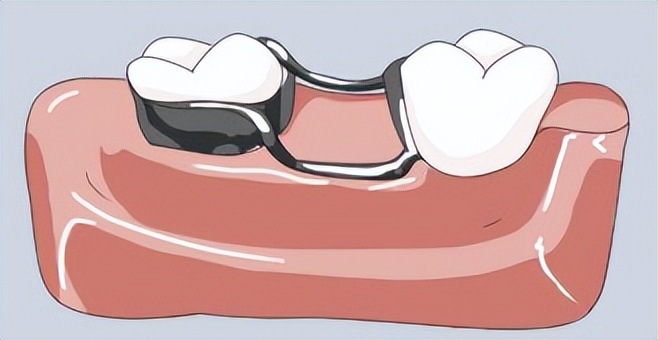 7岁小孩睡觉张嘴打鼾,5岁小朋友打鼾