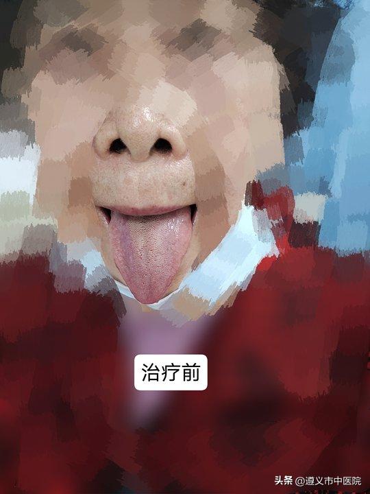 易生病体质怎么调,易感体质可以中医调理吗